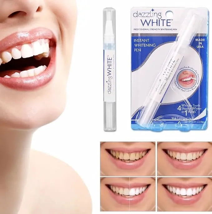 Stylo Blanchissant Dents – Sourire Plus Blanc et Éclatant