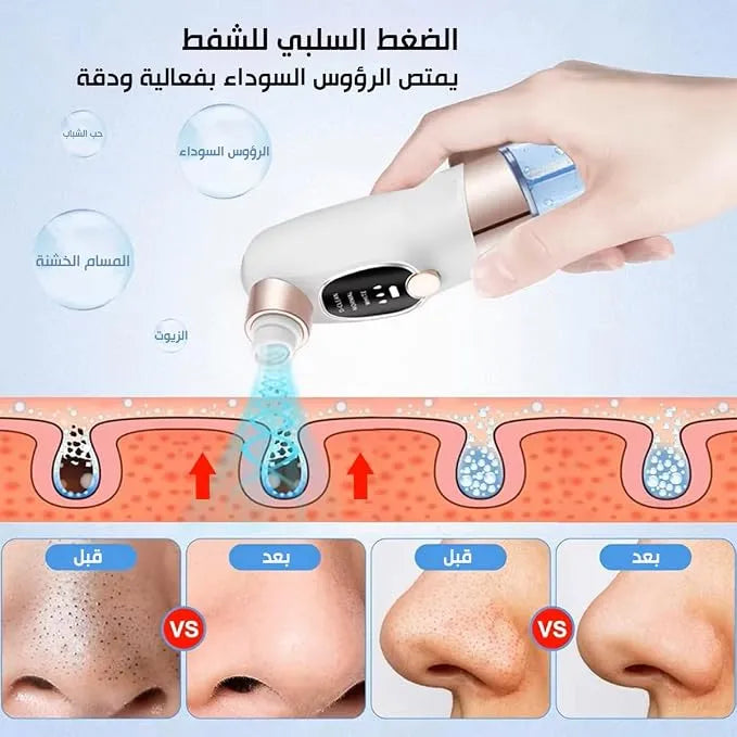 Nettoyeur Point Noir Hydratant avec Écran LED et Effet Bulles