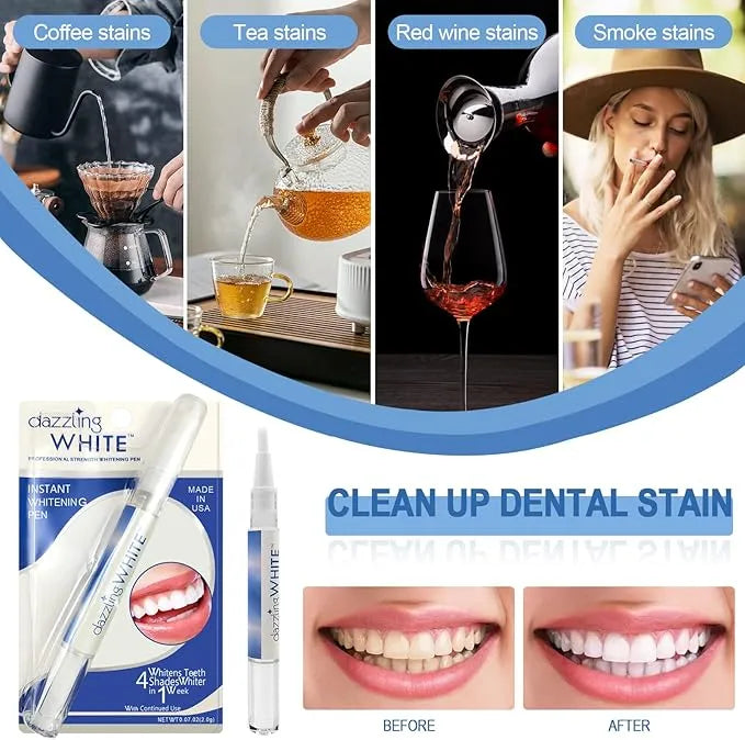Stylo Blanchissant Dents – Sourire Plus Blanc et Éclatant