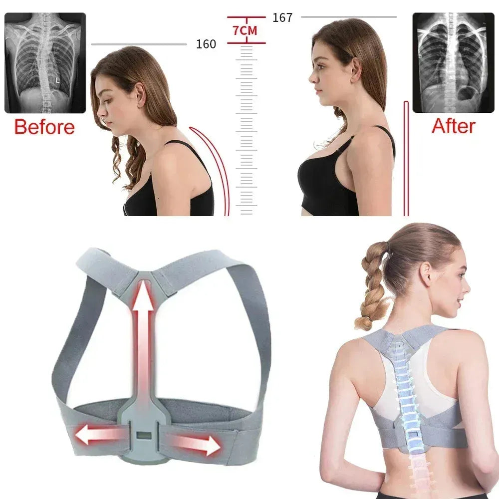 Correcteur de Posture Confortable pour un Dos Plus Droit
